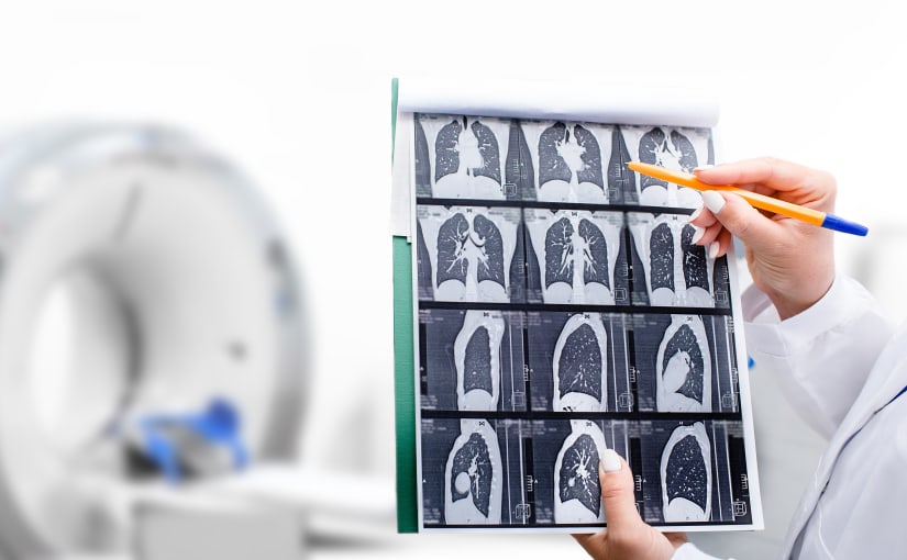 Lung scan