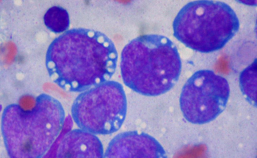 Blood film