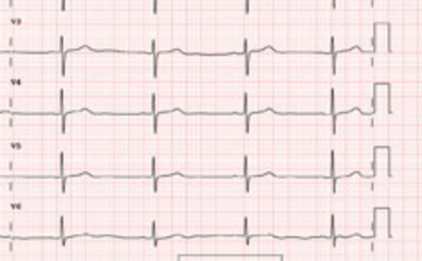 Echocardiogram example