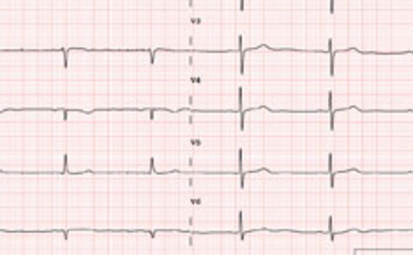 Echocardiogram example
