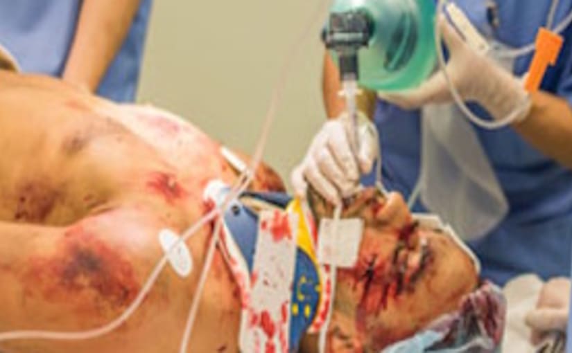 shocked patient